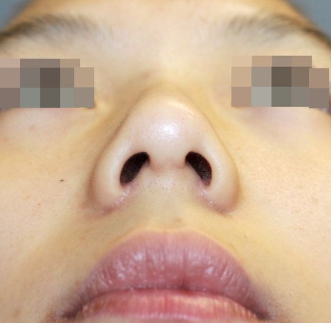 20161212po3Mあおり